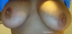 Busty Breast Reductions - Set 05
