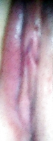 My pics