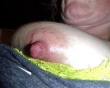Nips
