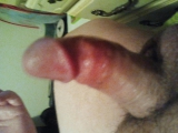 Penis