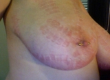 Big Natural Boobs Tortured With Over 100 pegs Vol1