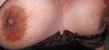 My Nipples