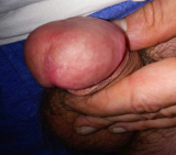 Meine Penis schwanz bilder im internet