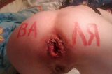 anal hole