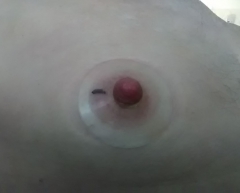self nippel play - N