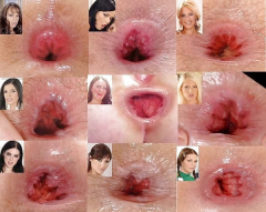 anal hole - N