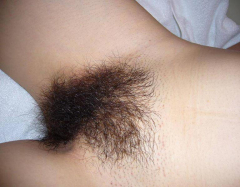 She and her wonderful hairy pussy 5 - N